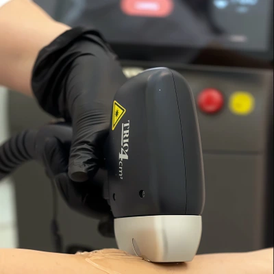 -30% на лазерную эпиляцию на единственном в Мытищах аппарате Soprano Titanium